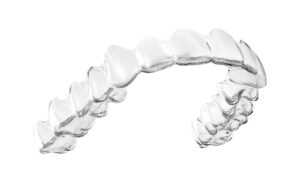 Invisalign-2